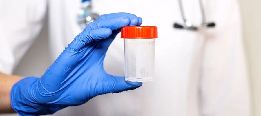 Where can I buy donor sperm?