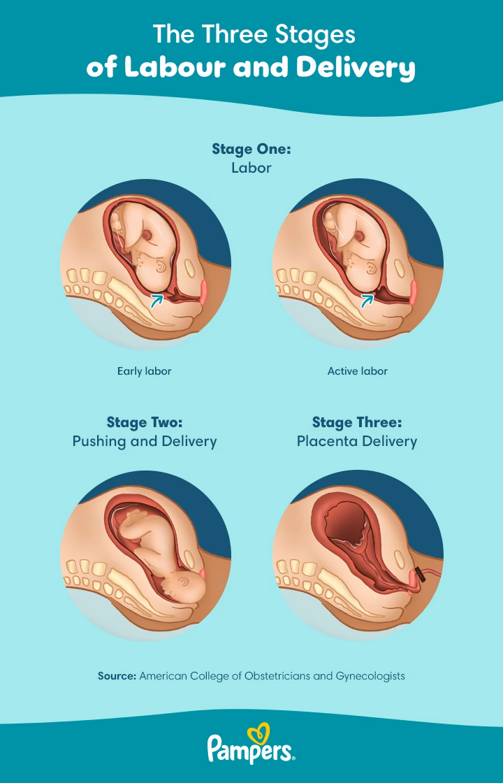 Does labor start naturally in all pregnancies?