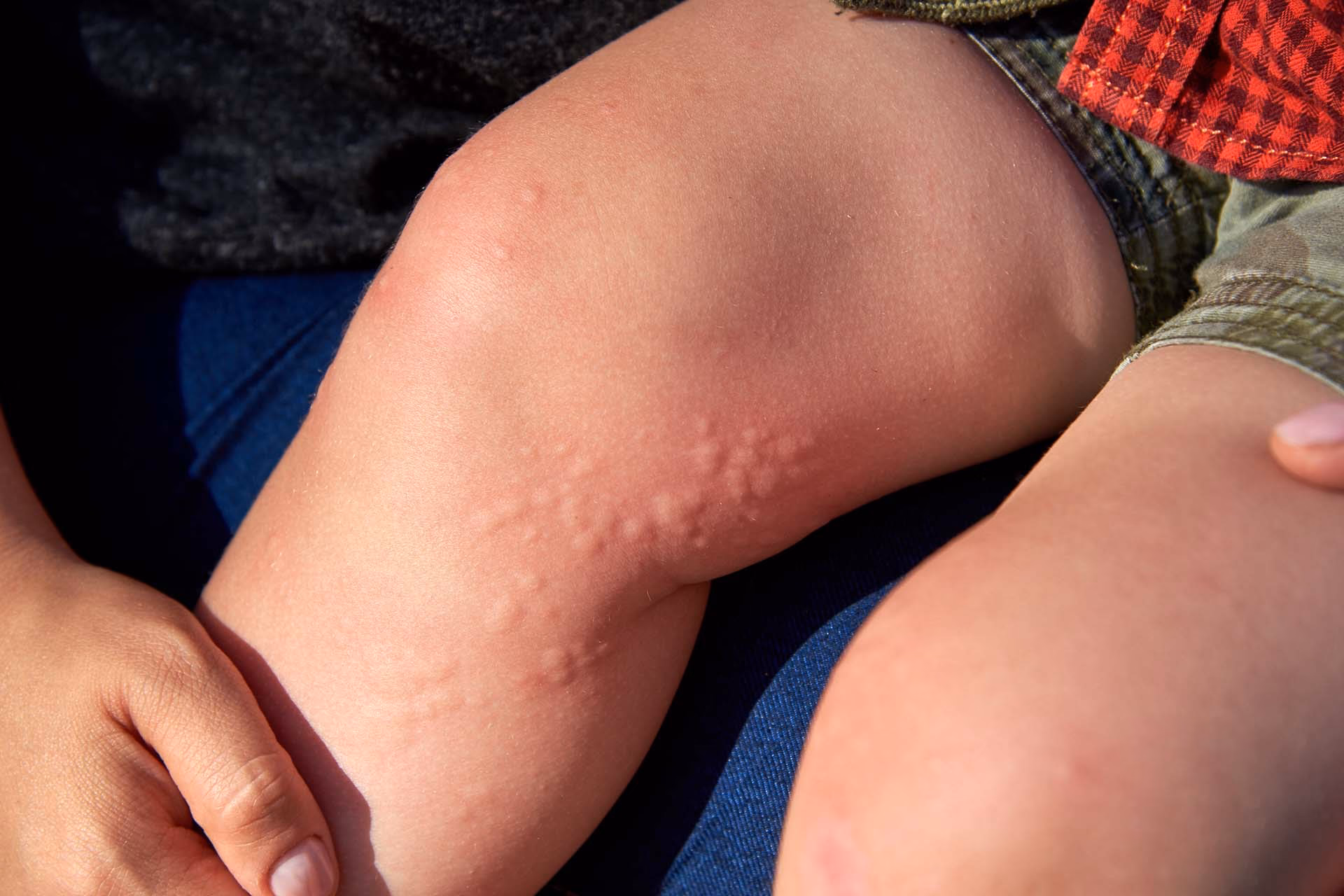When is grass allergy season?