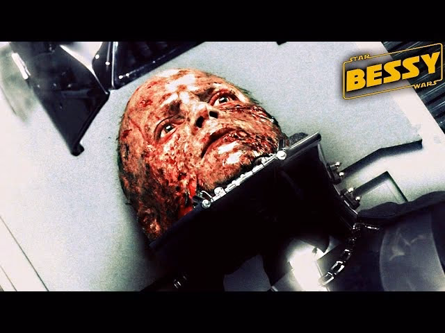 What happened to Anakin in Darth Vader?