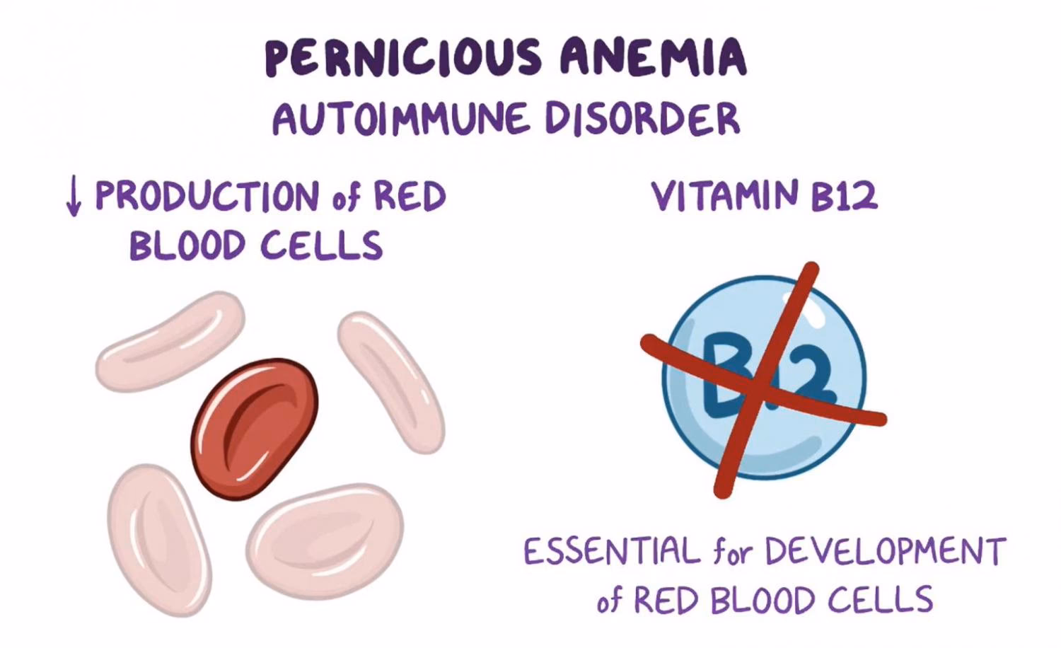 What is a myth about pernicious anemia?