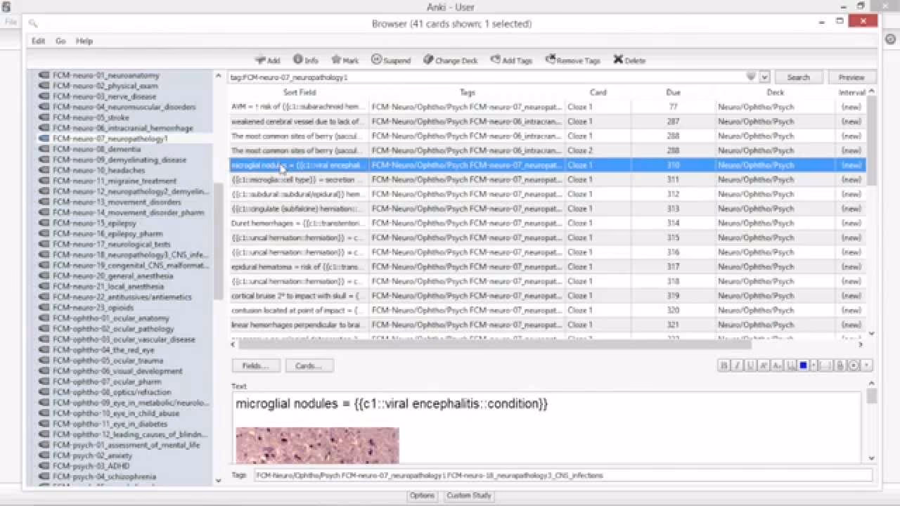 Is Anki a good card to use as a medical student?