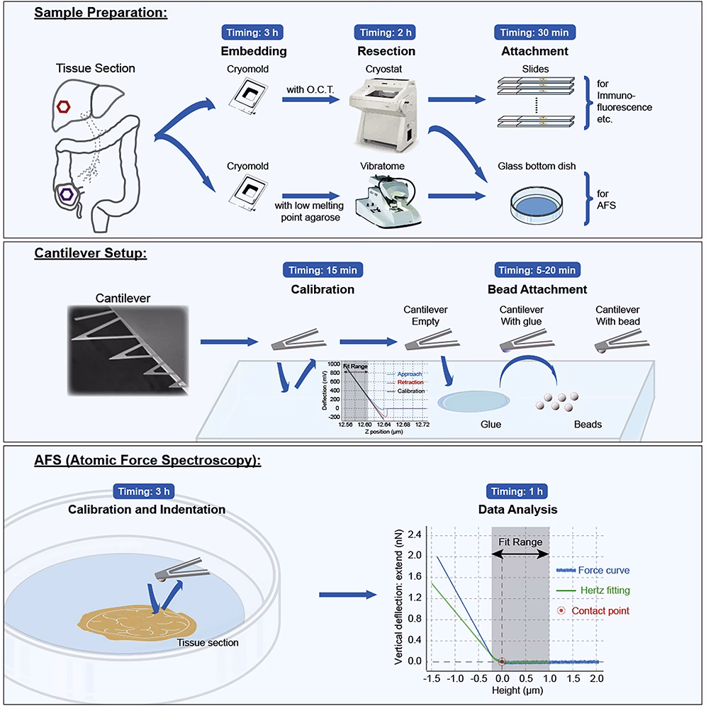 What happens if a specimen is transferred from operation theater to pathology?