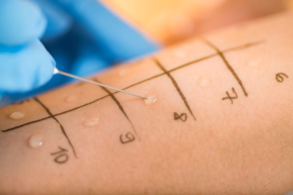 Do I need allergy testing?