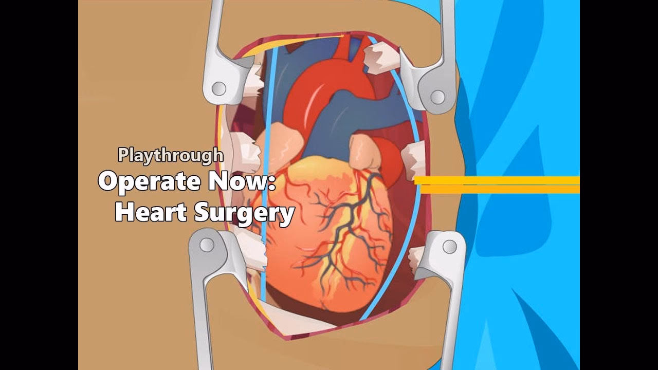 What are operate now games?