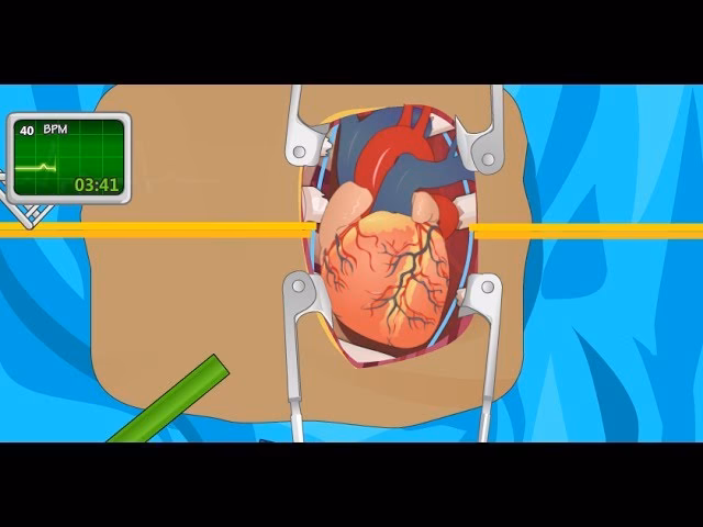 Is heart surgery a free online game?