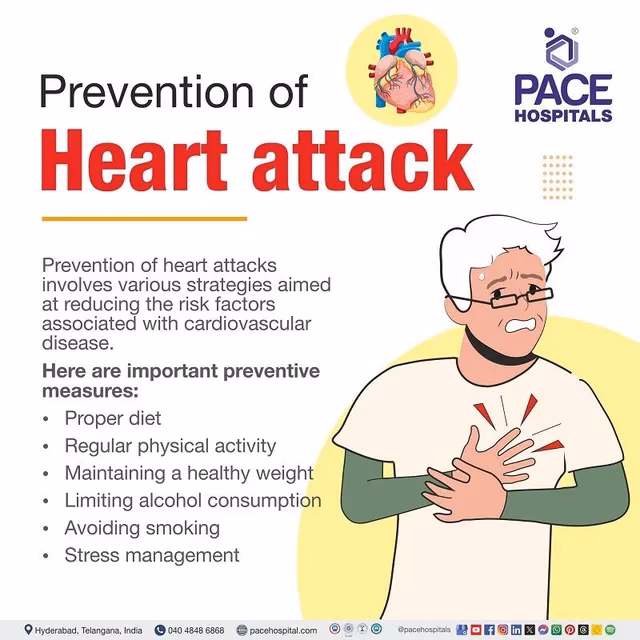 When should I start treatment for a heart attack?