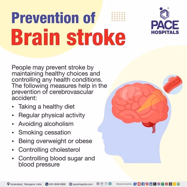 What should I do if I think someone has a stroke?