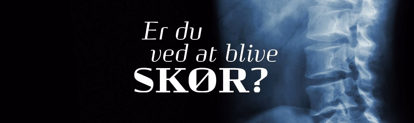 Hvad koster håndkøbslægemidler?