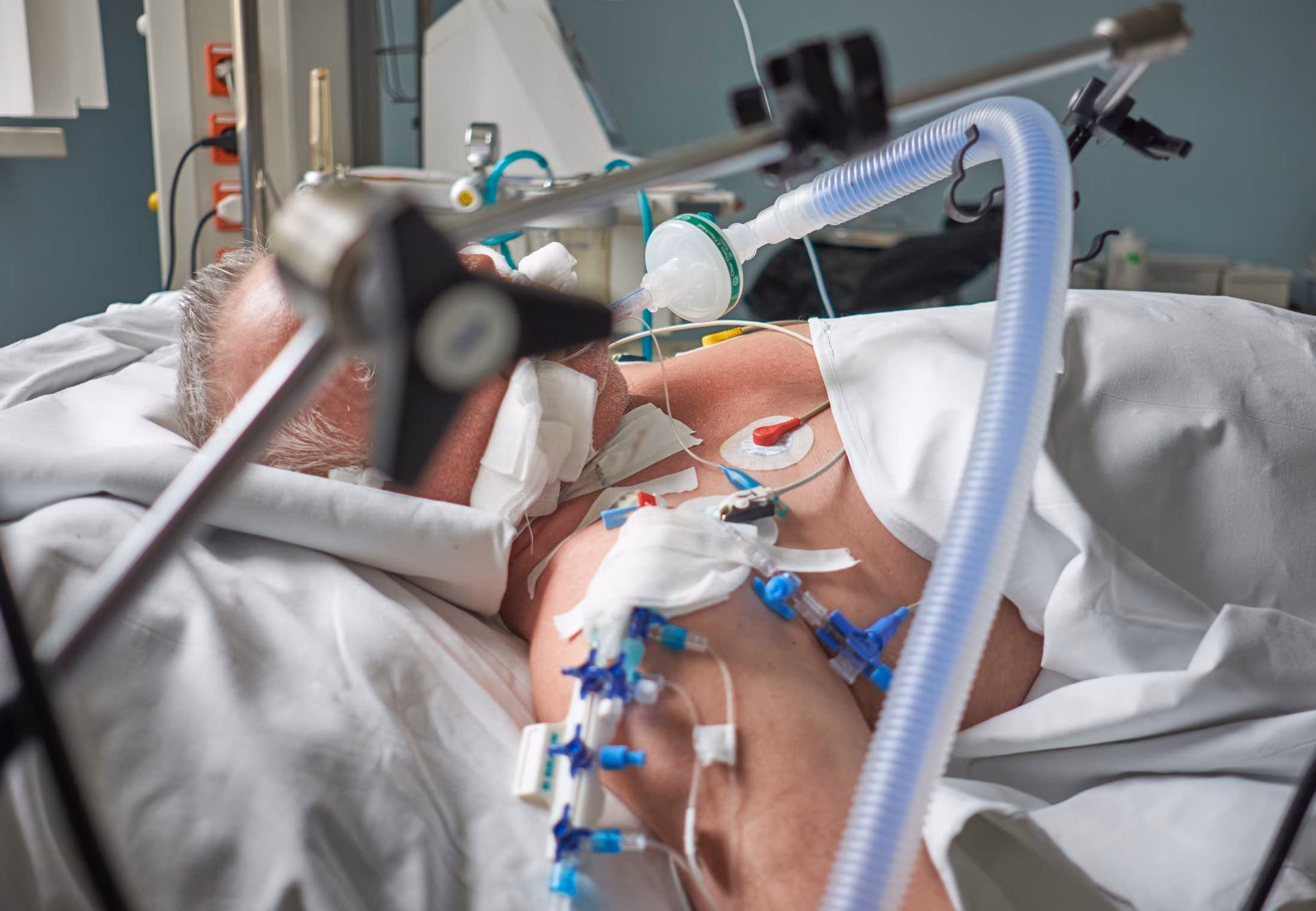 Hvilke bivirkninger har en kunstig koma?