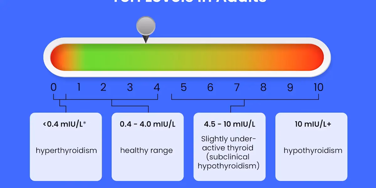 What is mild hyperthyroidism?