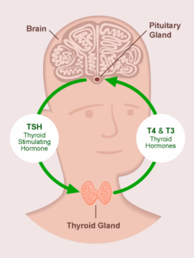 What causes hyperthyroidism in children?