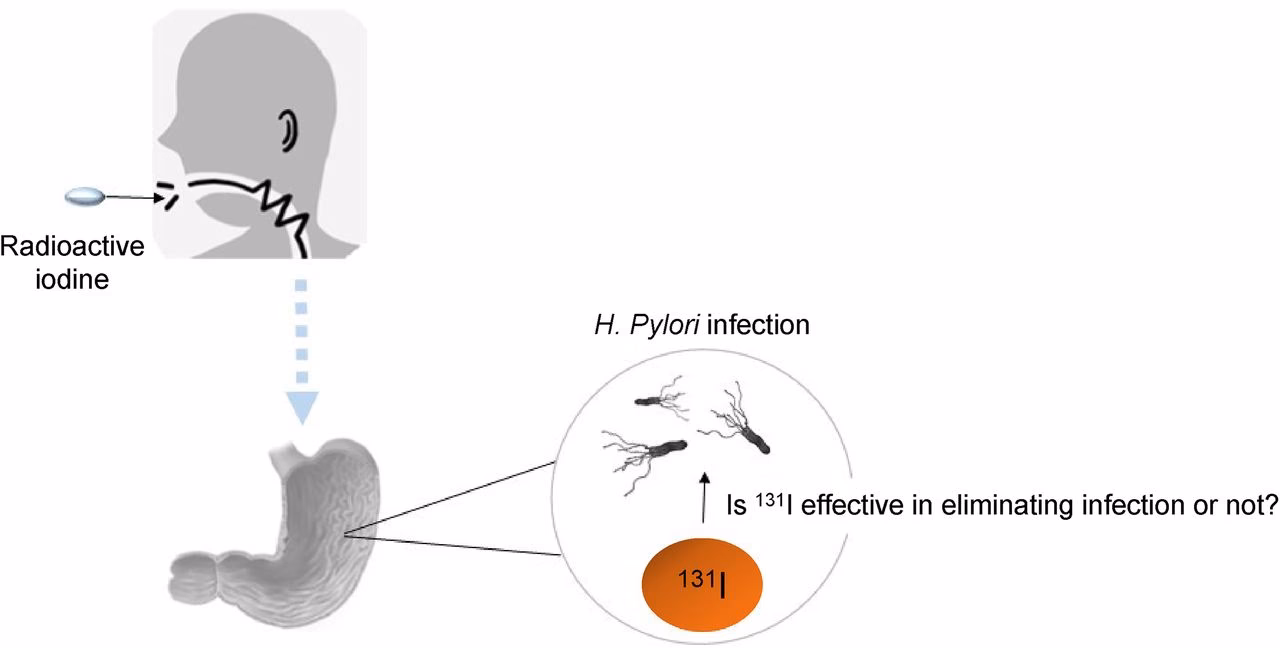 Does Helicobacter pylori infection cause autoimmune thyroid diseases?