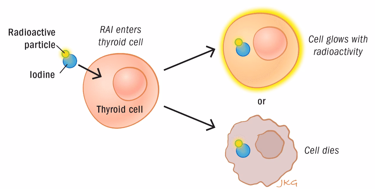 What is a normal Raiu for hyperthyroidism?