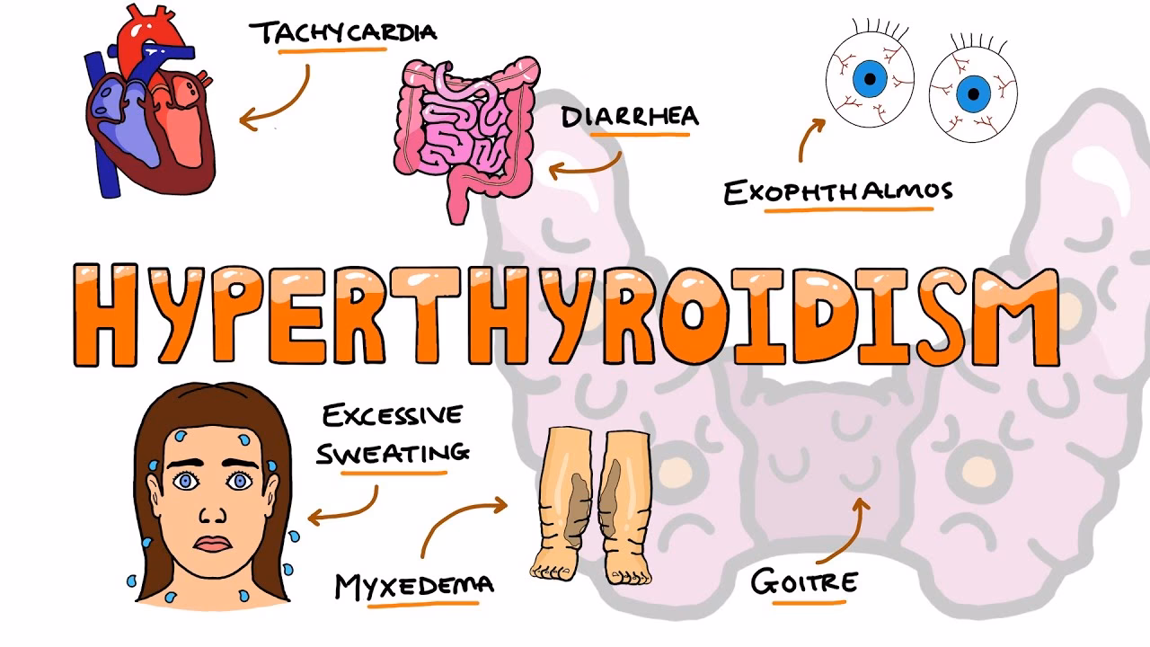 What are the symptoms of an overactive thyroid?