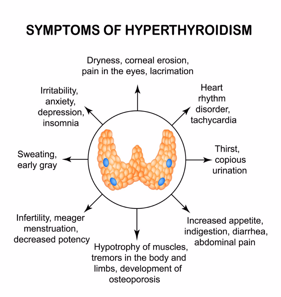 Can hypothyroidism cause urinary retention?