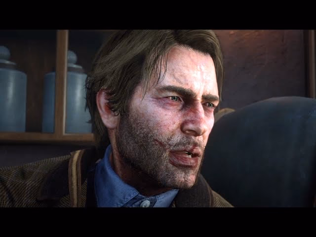 Does Arthur have TB in RDR2?