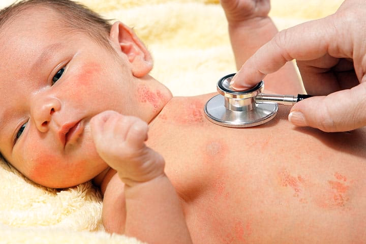 Can newborns get chickenpox?