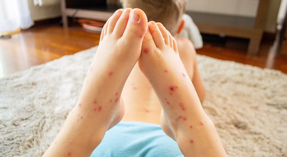 What are specific codes in ICD 10?