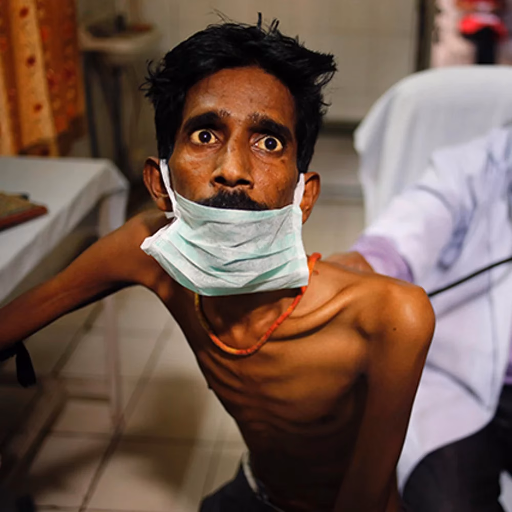 What is tuberculosis journal?