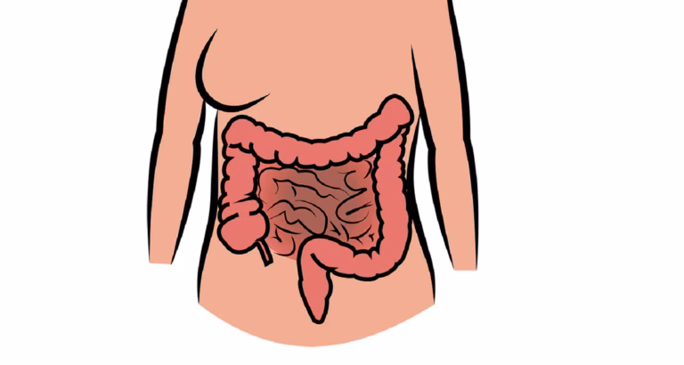 Hvad er årsagen til mave-tarm-infektion?