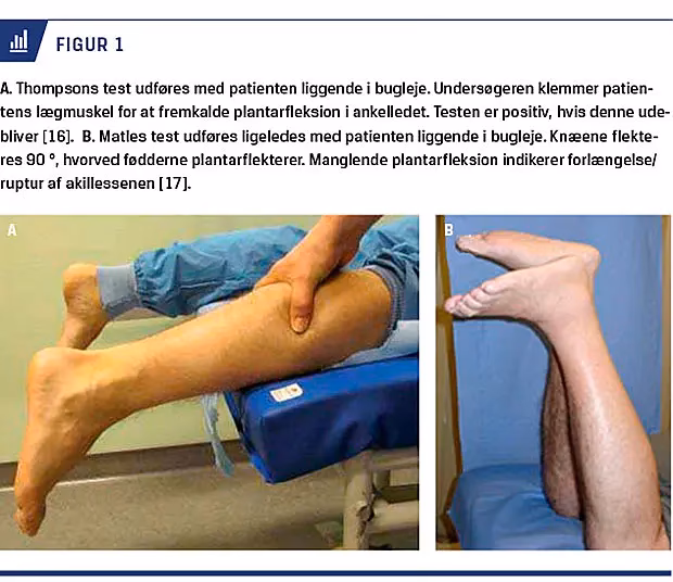 Hvad er årsagen til svaghed i benene?