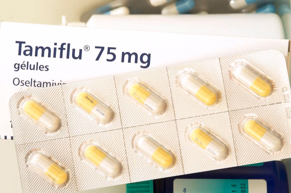 What are the treatment options for influenza?