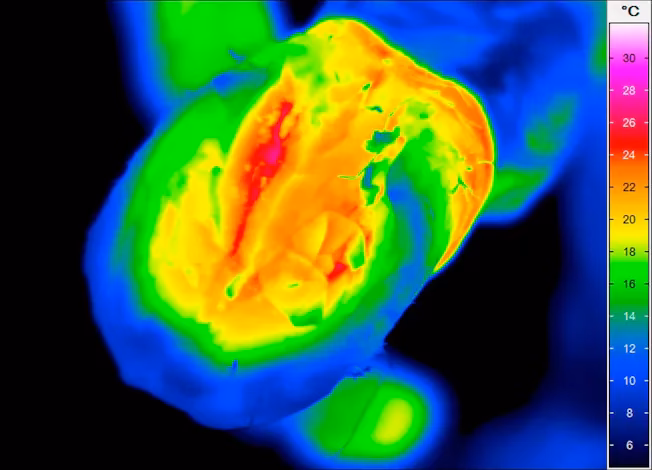 How a medical infrared thermal imager is suitable for medical application?