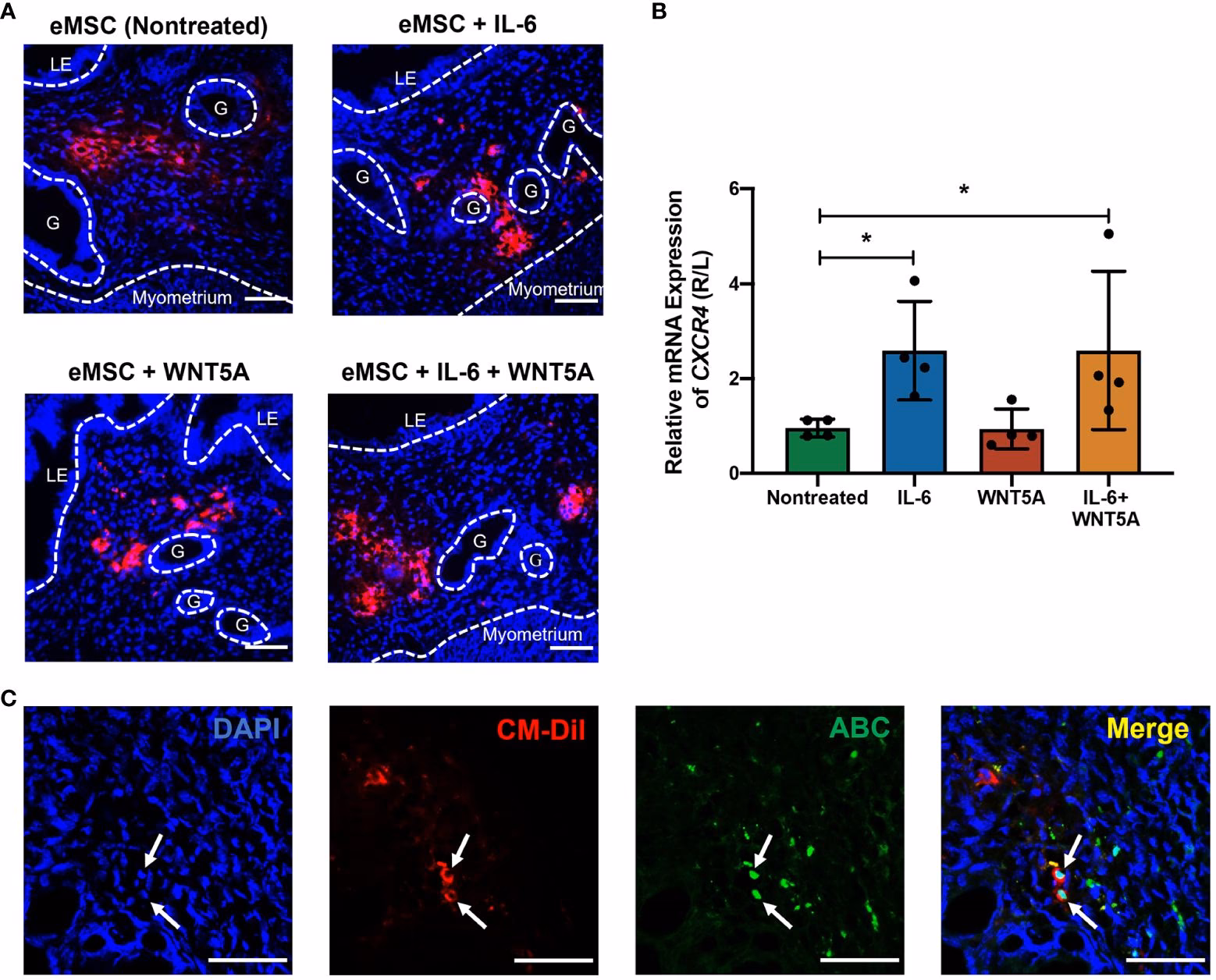 Are IL-6 cytokines a good candidate for endometriosis?