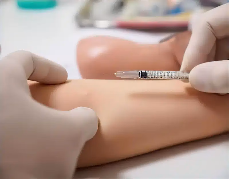 How long does an intradermal allergy test take?