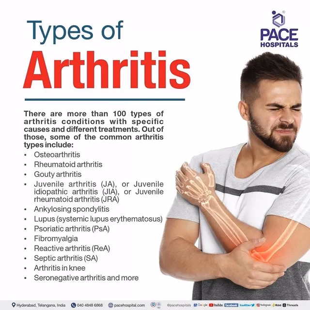 Is arthritis a rheumatic disease?