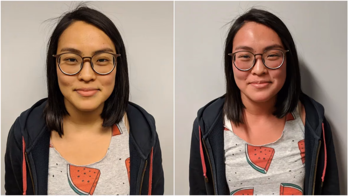 What causes Asian flush?