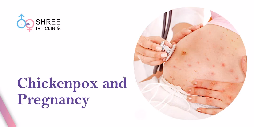 Can a pregnant person get chickenpox?