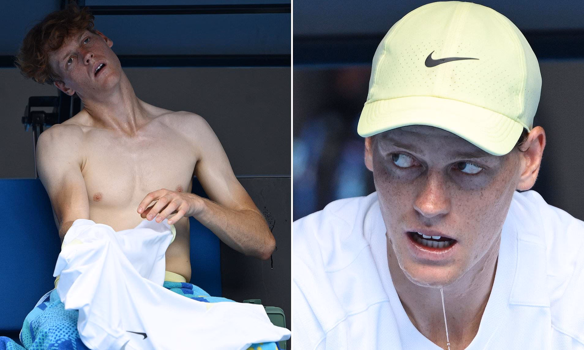 Why did Jannik Sinner lose to Holger Rune?