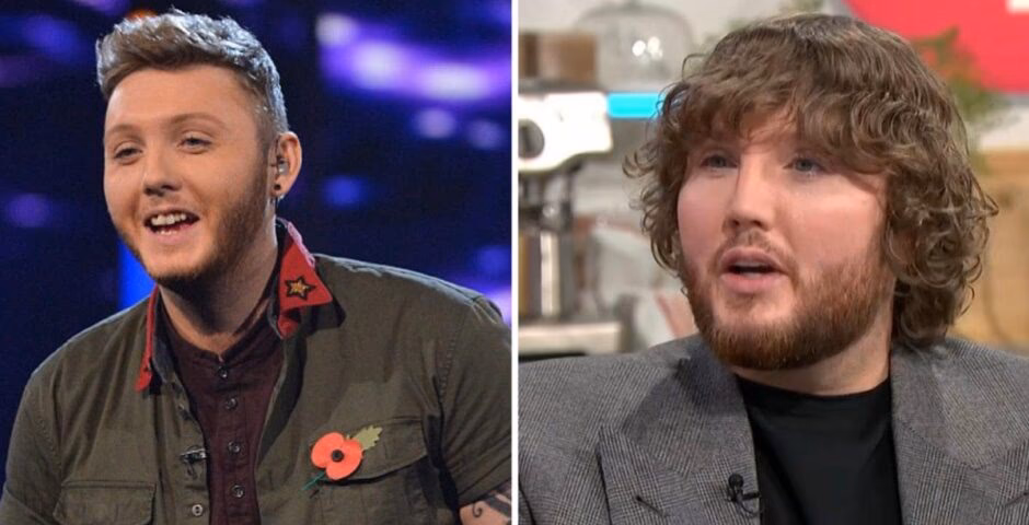 Did James Arthur go under the knife to straighten his nose?