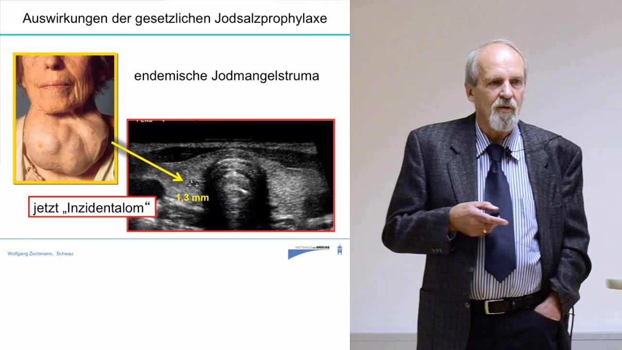 Wie wirkt sich Jodmangel auf die Schilddrüse aus?