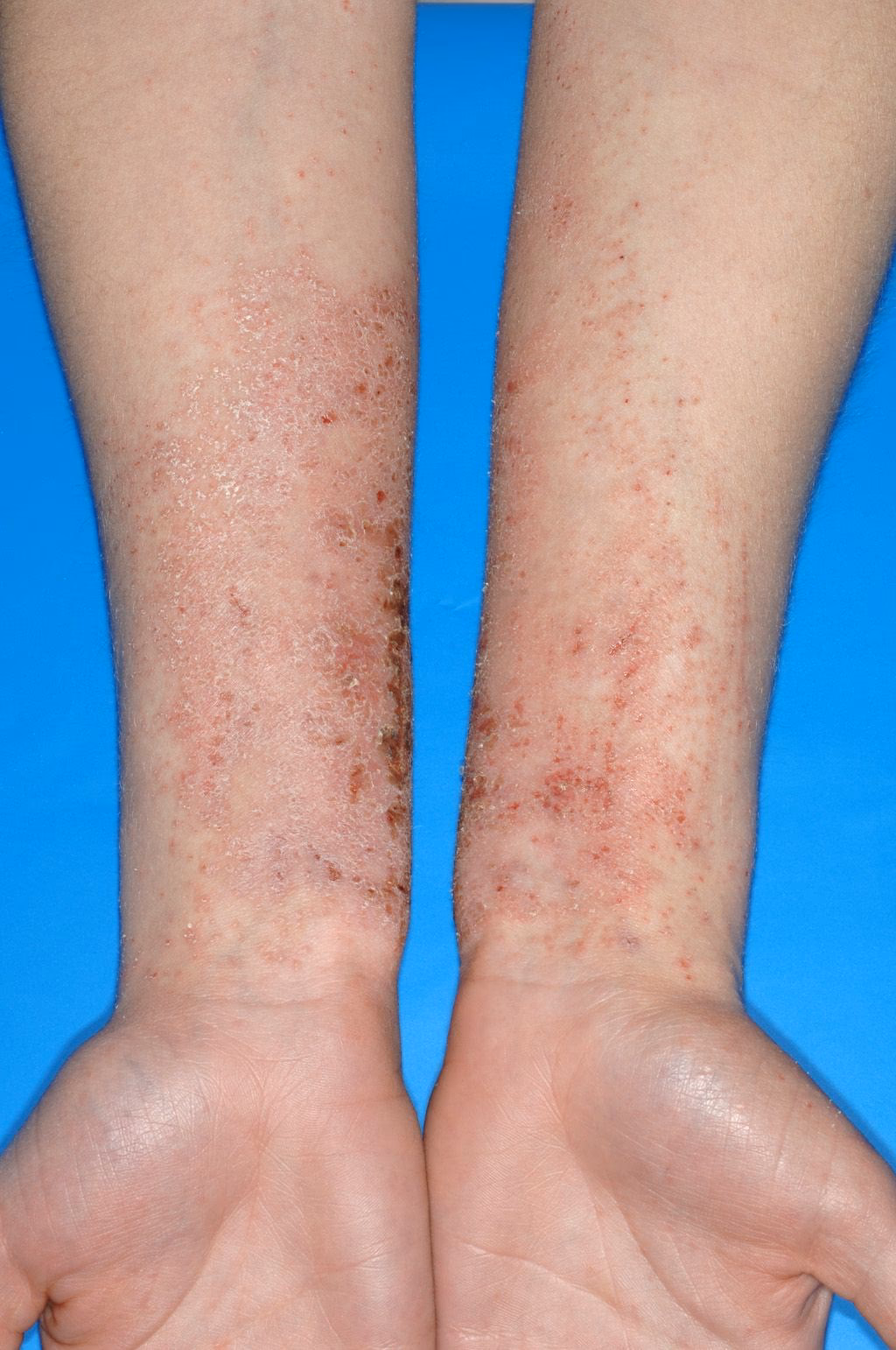 Was ist Kaliumdichromat und wie wirkt es?