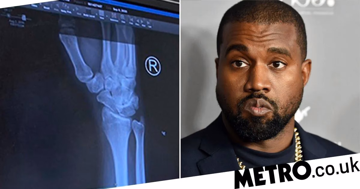 Why did Kanye West get a call from his doctor?