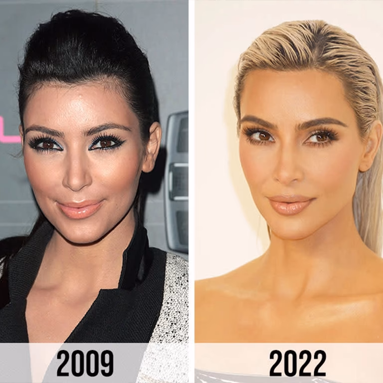 Did Kim Kardashian get surgery to lose baby weight?