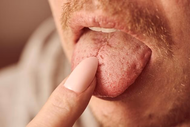 Wie macht sich eine Kiwi Allergie bemerkbar?