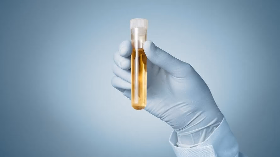 How is Klebsiella pneumoniae in urine diagnosed?