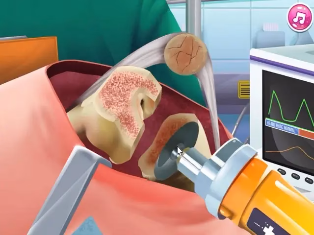 Is knee case simulator a good surgery game?