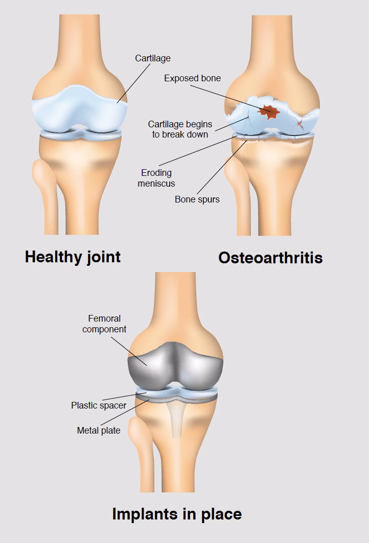 Does intervention training improve postoperative knee function?