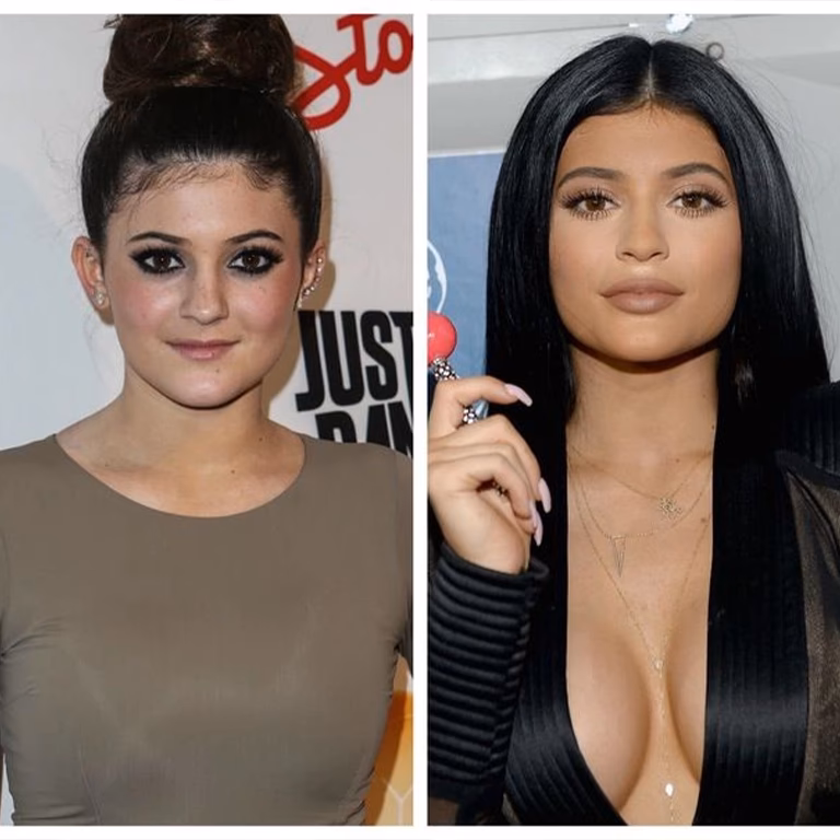 Did Kylie Jenner have a baby bump?
