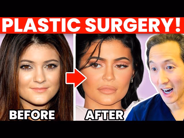 Did Kylie Jenner get cosmetic work done as a teenager?