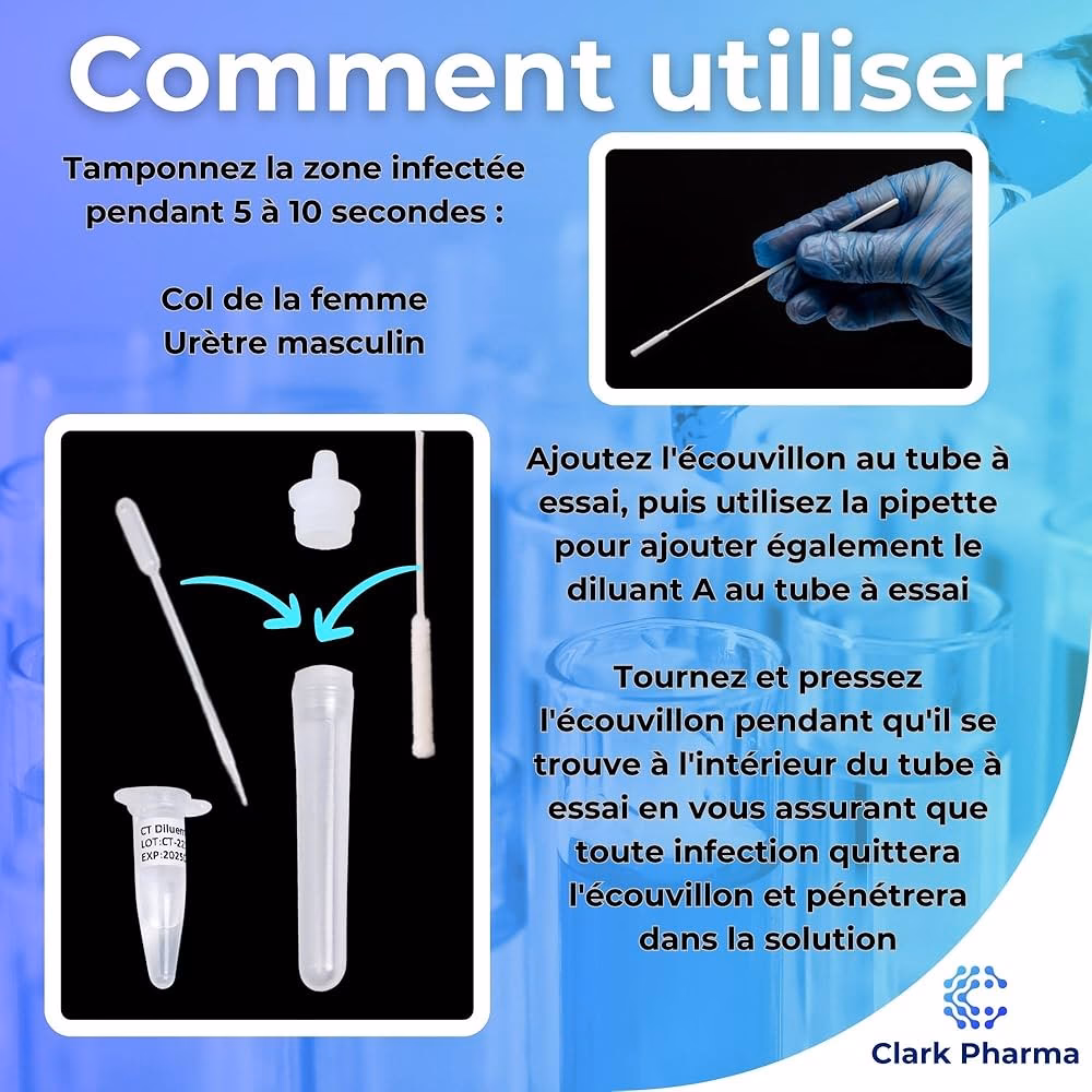 Quels sont les symptômes de la chlamydia ?