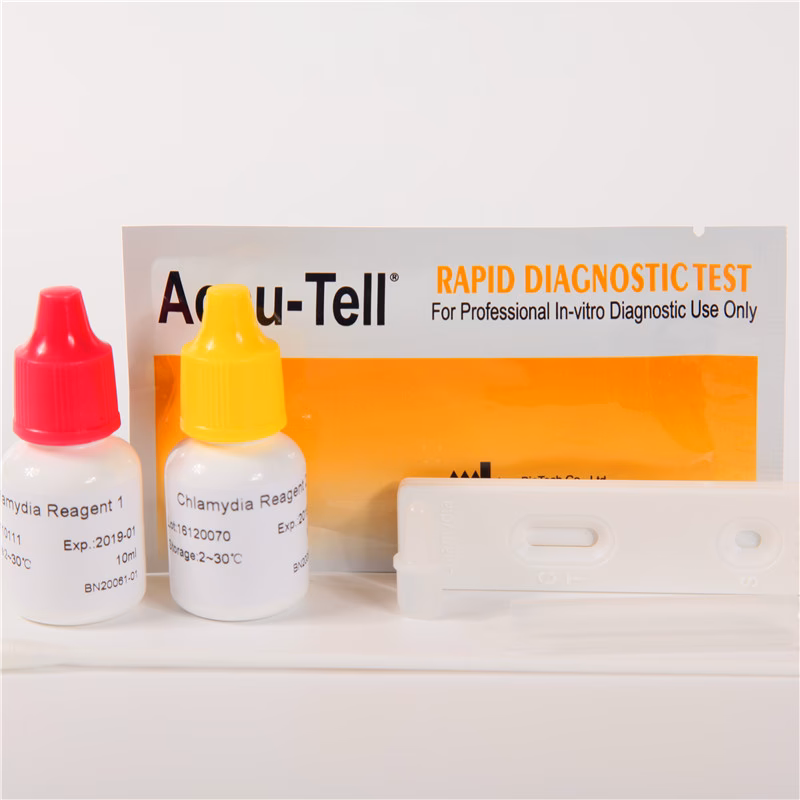 Quels sont les avantages du test Chlamydia ?