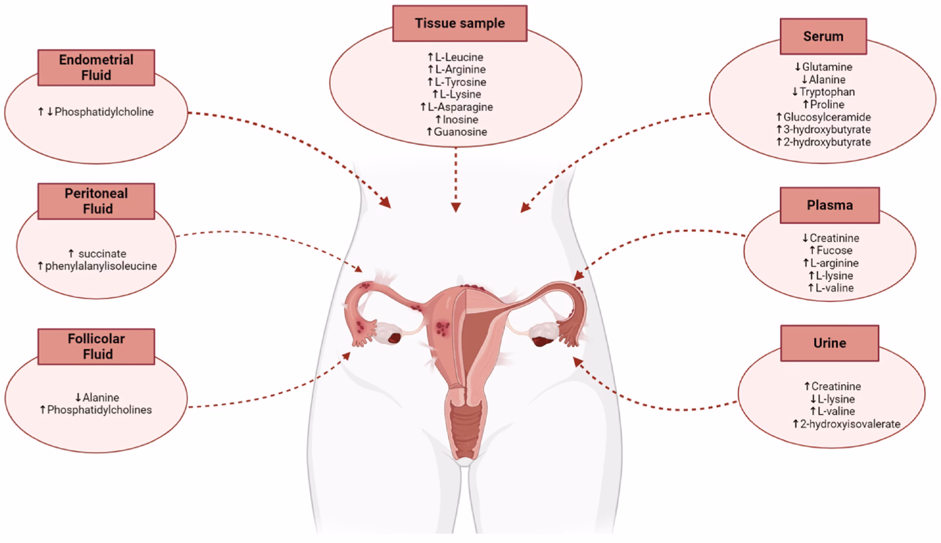 Does glutamine affect ectopic endometrial cells?