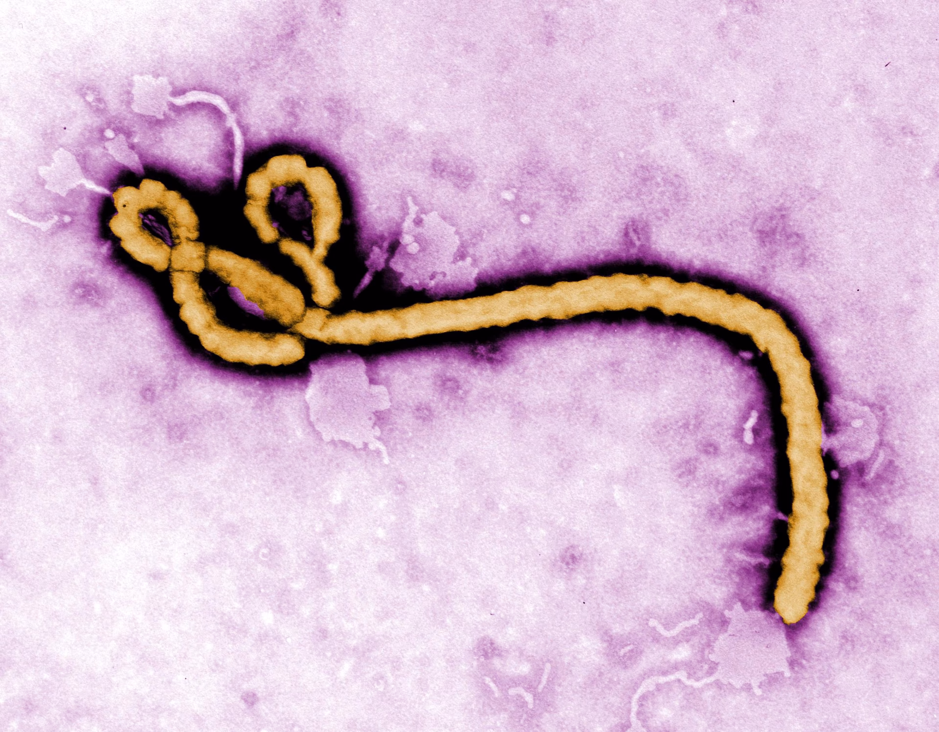 Quels sont les différents types de virus Ebola ?