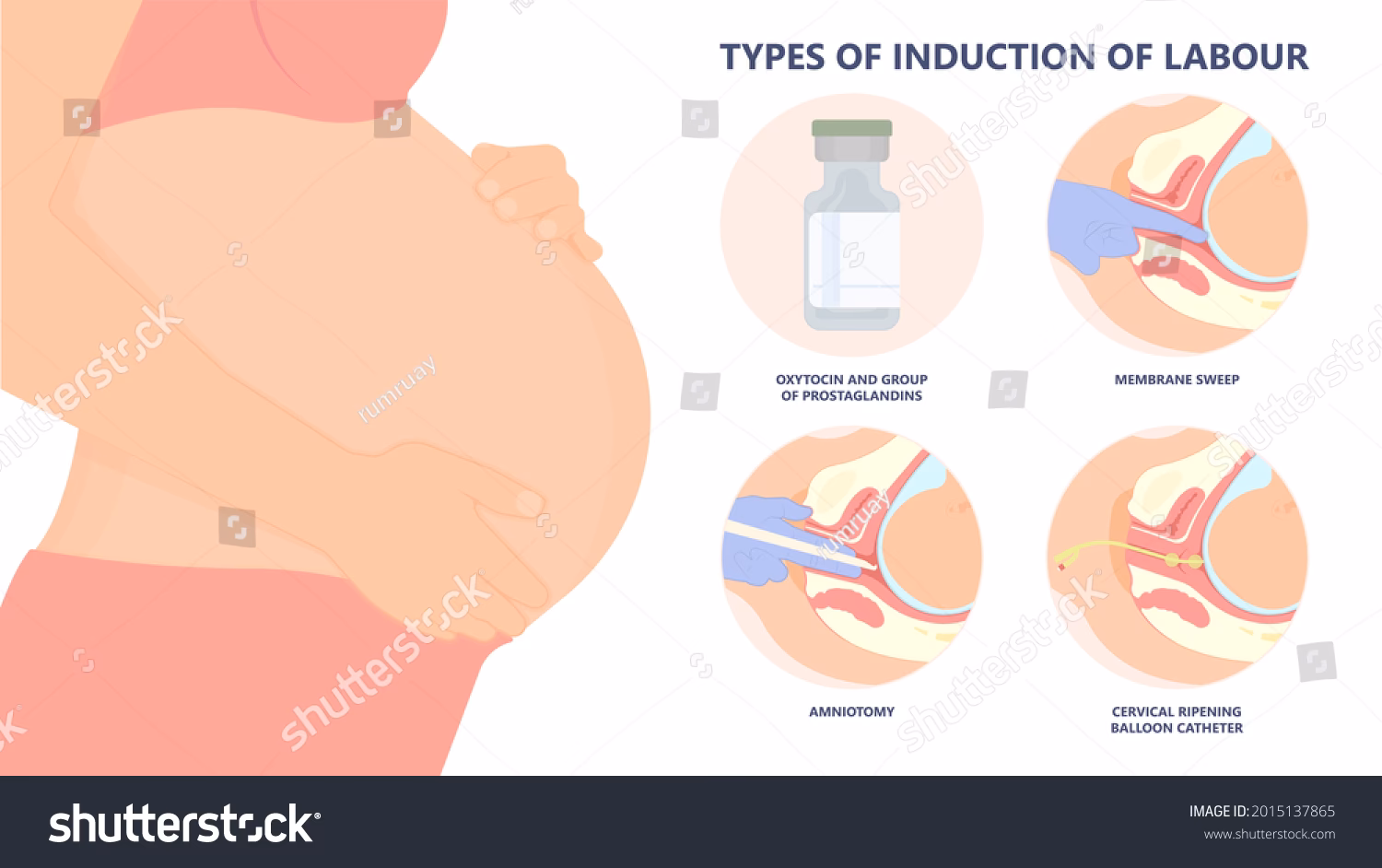 How much does induction of labour cost?